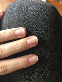 What your nails say about your health - Jamaica Observer